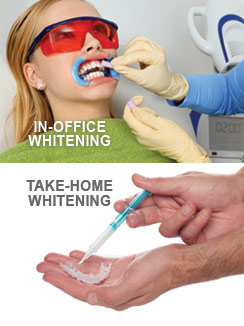 In-Office & Take-Home Teeth Whitening