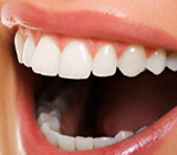 about-teeth-whitening