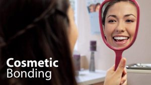 cosmetic-bonding