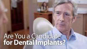 implant-candidate