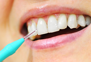 Interdental Cleaning Devices Lincoln Park, Lakeview, Chicago