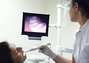 intra-oral-camera