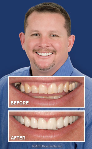 Smile Makeover Dentists Lincoln Park, Lakeview, Chicago