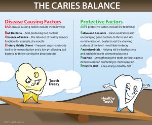 Fluoride Prevents Tooth Decay Lakeview